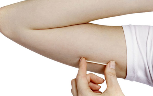Anvisa amplia de 3 para 5 anos a duração do implante contraceptivo Implanon NXT 